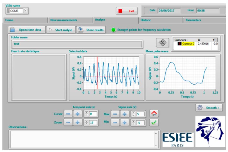 Pulse Wave Monitoring For Arterial Stiffness Detection Using A Simple 