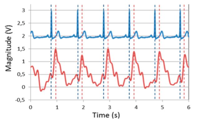 Figure 6. Comparison between classical ECG (blue) with our sensor (red) measuring the pulse wave