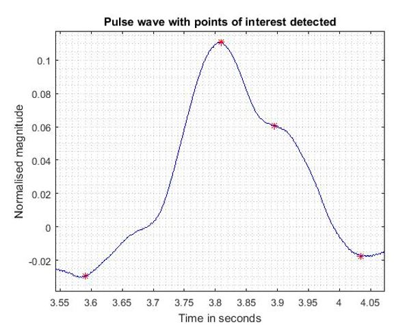 Figure 8. Pulse wave with points of interest detected