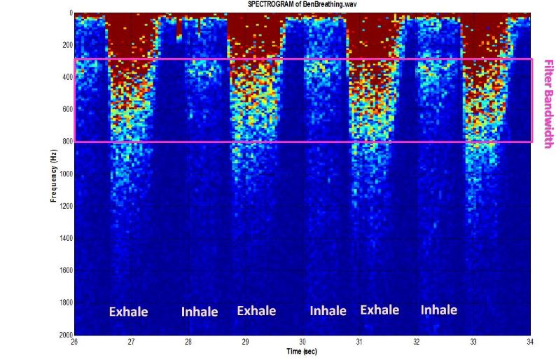 Figure 4 Spectrogram of breathing–Credit: Dr. Pilkington