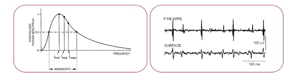 Figure 1. Sketch of a typical raw EMG signal recorded with fine wires or patch electrodes