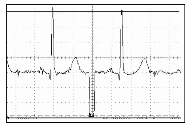Figure 27 File stdb_313 Snapshot taken on Oscilloscope 